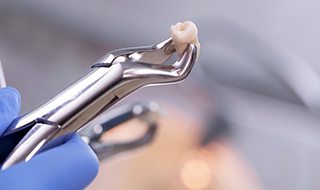 a dentist holding an extracted tooth with forceps