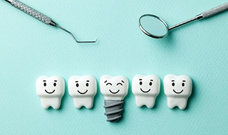 Illustration of dental implant in Burlington
