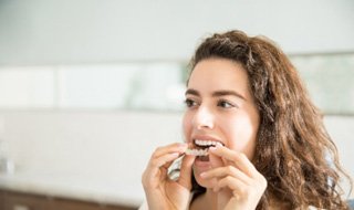 Woman in white shirt placing Invisalign aligner on top teeth
