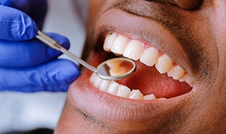 Closeup of healthy smile