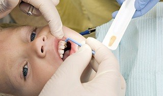 Child receiving fluoride treatment