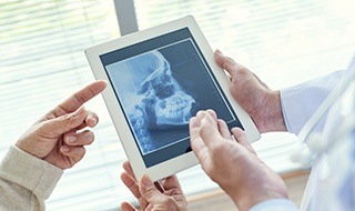 Digital x-ray of jaw and skull bones