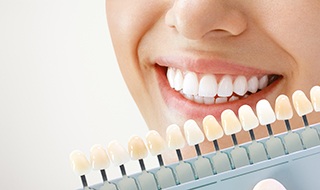 factors that go into determining the cost of your professional whitening treatment include what type of stains you have