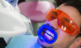 The price you pay for professional teeth whitening is influenced by the type of whitening you choose