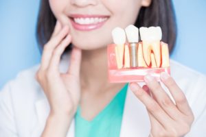 smiling dentist holding model of placed dental implants