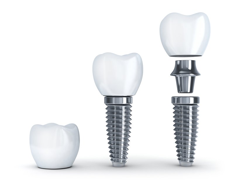 a digital image of a dental implant and all its parts